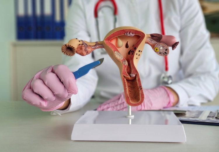 Recovering from Uterine Prolapse Surgical procedure: An Trustworthy, Unfiltered Account